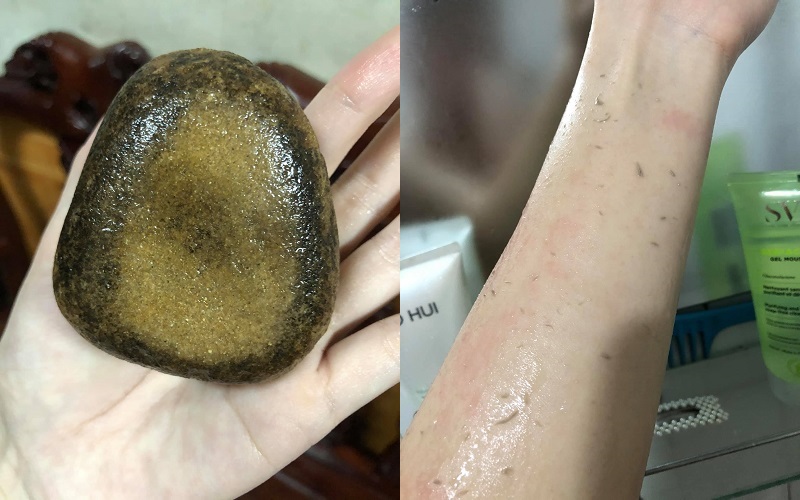 Tẩy tế bào chết bằng phương pháp vật lý