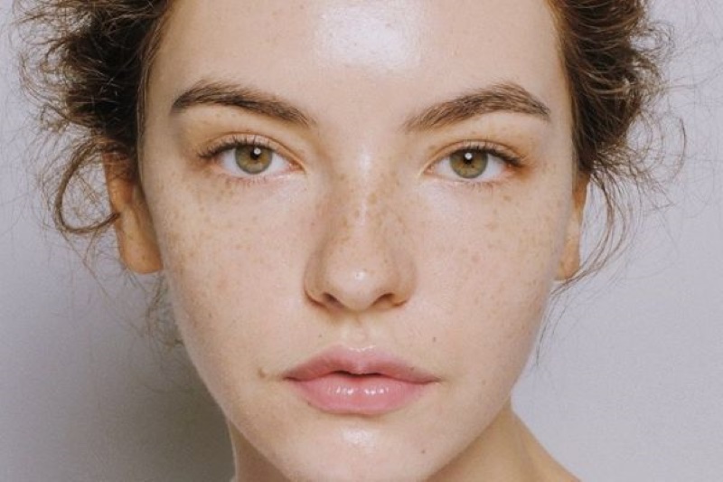 Da nhạy cảm với ánh nắng mặt trời