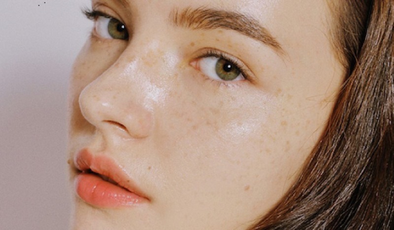 Những phương pháp loại bỏ tàn nhang